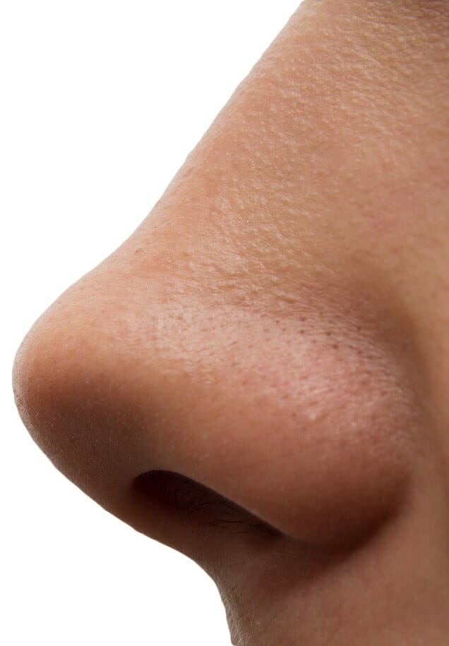 Pálenie zápachu v nosu